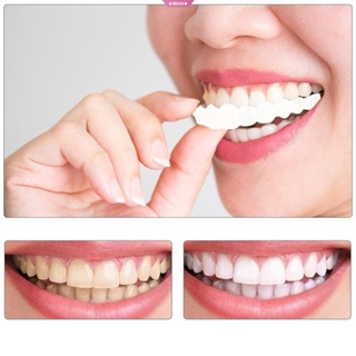 ✓ Tipos de dientes postizos - Dentistas Por Chile